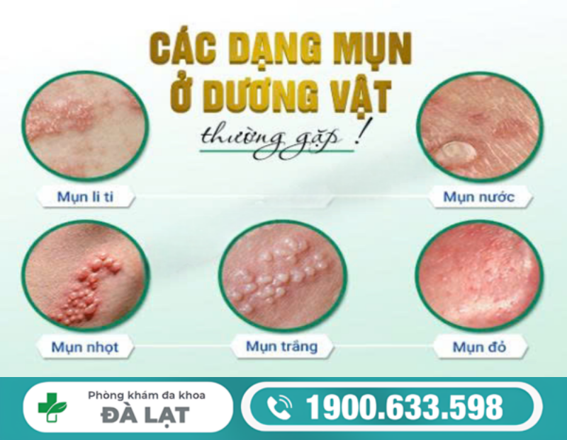 Hình ảnh minh họa